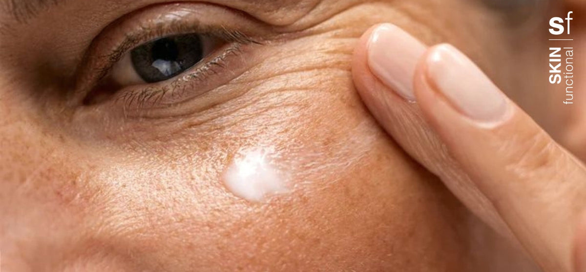 Hyperimpigmentation Skin Functional Pigmentation 101: What you need to know