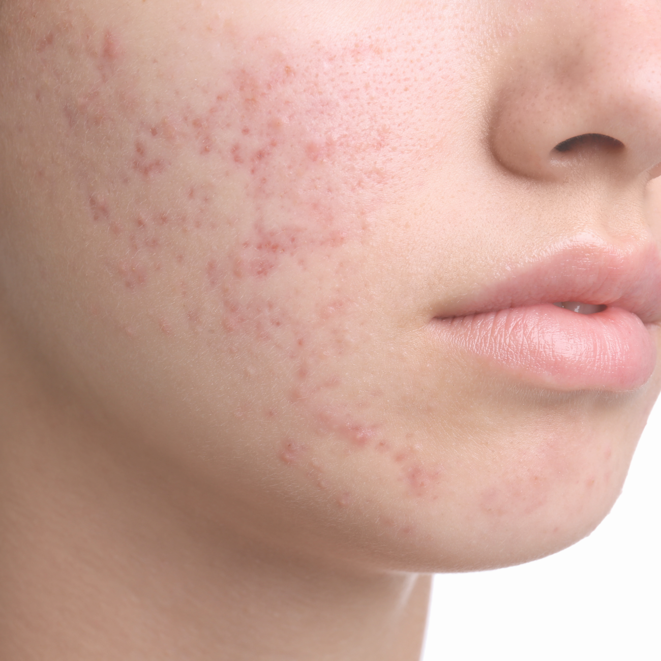 Skin Functional USA